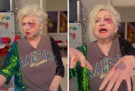 Wanna Marchi investita a Milano: "Sono devastata, ho rischiato la vita"