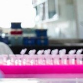 Milano, focolaio di tubercolosi all'Istituto di Medicina legale: 8 casi conclamati e 7 positivi. Indagini sull'origine del contagio