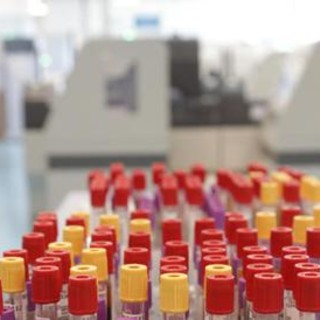 Malaria in aeroporto in Germania, gli esperti: "Campanello d'allarme, ma il rischio resta contenuto"