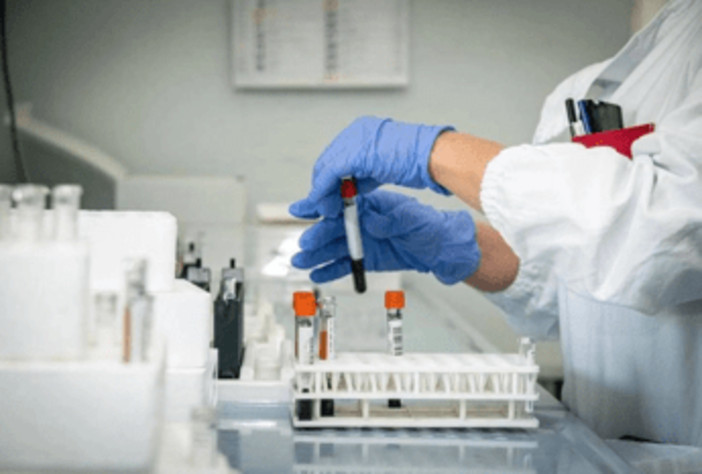 Alzheimer, allo studio nuovo test del sangue per diagnosi precoce