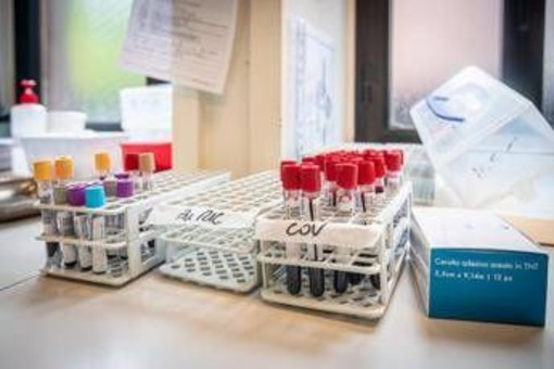 Medicina di laboratorio, 'un semplice esame per scoprire in anticipo le patologie' Medicina di laboratorio, 'un semplice esame per scoprire in anticipo le patologie'