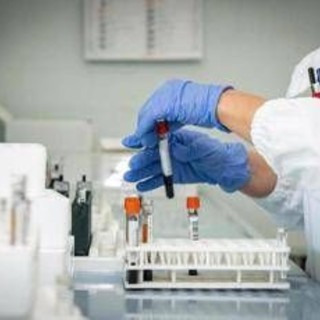 Epatite A, crescono i casi: sesso e alimenti, come si prende e sintomi